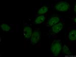 CTBP1 Antibody in Immunocytochemistry (ICC/IF)