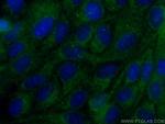 CEP63 Antibody in Immunocytochemistry (ICC/IF)