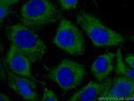 GNAI2 Antibody in Immunocytochemistry (ICC/IF)