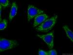 CES1 Antibody in Immunocytochemistry (ICC/IF)