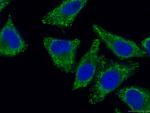 ATG9A Antibody in Immunocytochemistry (ICC/IF)