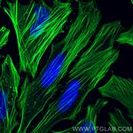 FLNA Antibody in Immunocytochemistry (ICC/IF)