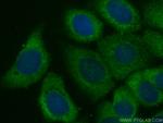 GBP1 Antibody in Immunocytochemistry (ICC/IF)