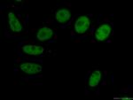 HDAC2 Antibody in Immunocytochemistry (ICC/IF)