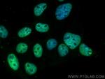 TRIB2 Antibody in Immunocytochemistry (ICC/IF)