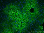 CYP2E1 Antibody in Immunohistochemistry (PFA fixed) (IHC (PFA))