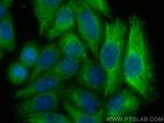 GSDMB Antibody in Immunocytochemistry (ICC/IF)