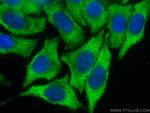 GPT/ALT1 Antibody in Immunocytochemistry (ICC/IF)