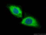 CCT7 Antibody in Immunocytochemistry (ICC/IF)