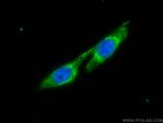 UAP1 Antibody in Immunocytochemistry (ICC/IF)