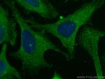 PICALM Antibody in Immunocytochemistry (ICC/IF)