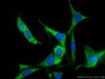 ANGPTL4 Antibody in Immunocytochemistry (ICC/IF)