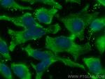 Alix Antibody in Immunocytochemistry (ICC/IF)