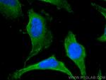 PRKAR2A Antibody in Immunocytochemistry (ICC/IF)