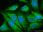 ITCH Antibody in Immunocytochemistry (ICC/IF)