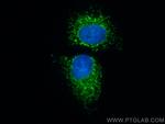 TUFM Antibody in Immunocytochemistry (ICC/IF)