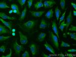 BAD Antibody in Immunocytochemistry (ICC/IF)