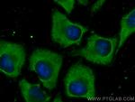 GEMIN8 Antibody in Immunocytochemistry (ICC/IF)