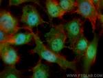 PARG Antibody in Immunocytochemistry (ICC/IF)