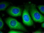 TrpRS Antibody in Immunocytochemistry (ICC/IF)