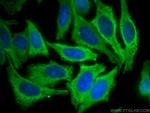 FAH Antibody in Immunocytochemistry (ICC/IF)