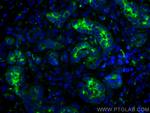 MMP7 Antibody in Immunohistochemistry (PFA fixed) (IHC (PFA))