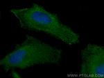 TBC1D4 Antibody in Immunocytochemistry (ICC/IF)