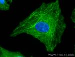 LASP1 Antibody in Immunocytochemistry (ICC/IF)