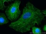 LASP1 Antibody in Immunocytochemistry (ICC/IF)