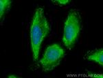 NCAPG Antibody in Immunocytochemistry (ICC/IF)