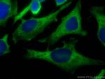 EEF1G Antibody in Immunocytochemistry (ICC/IF)