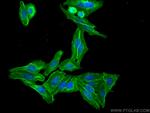 CAP1 Antibody in Immunocytochemistry (ICC/IF)