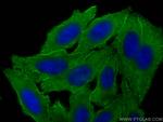 CAP1 Antibody in Immunocytochemistry (ICC/IF)