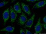 NDUFS1 Antibody in Immunocytochemistry (ICC/IF)