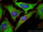 SNX17 Antibody in Immunocytochemistry (ICC/IF)