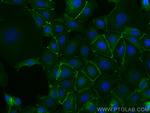 Beta Catenin Antibody in Immunocytochemistry (ICC/IF)