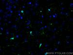 IBA1 Antibody in Immunohistochemistry (PFA fixed) (IHC (PFA))