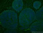 NDE1 Antibody in Immunohistochemistry (Paraffin) (IHC (P))