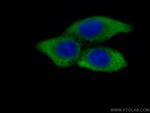 MMP9 Antibody in Immunocytochemistry (ICC/IF)