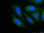 PEX14 Antibody in Immunocytochemistry (ICC/IF)