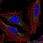 PEX14 Antibody in Immunocytochemistry (ICC/IF)