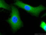 BAG3 Antibody in Immunocytochemistry (ICC/IF)