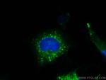 TIP47 Antibody in Immunocytochemistry (ICC/IF)