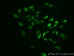 c-MYC Antibody in Immunocytochemistry (ICC/IF)