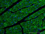 Myosin Light Chain 2/MLC-2V Antibody in Immunohistochemistry (Paraffin) (IHC (P))