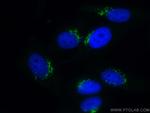 GOLGA2/GM130 Antibody in Immunocytochemistry (ICC/IF)