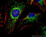 TOM20 Antibody in Immunocytochemistry (ICC/IF)