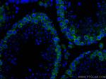 DAZL Antibody in Immunohistochemistry (Paraffin) (IHC (P))