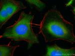 IMPDH2 Antibody in Immunocytochemistry (ICC/IF)