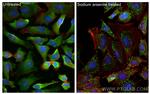 G3BP1 Antibody in Immunocytochemistry (ICC/IF)